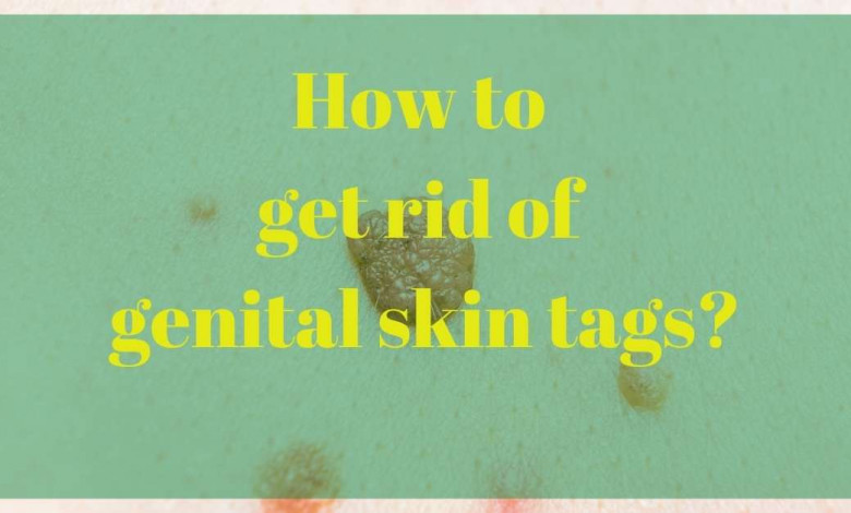 hwo to cure genital skin tags at home? https://organicgardeningeek.com